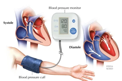 Can I Take an Extra Lisinopril If My Blood Pressure Is High?