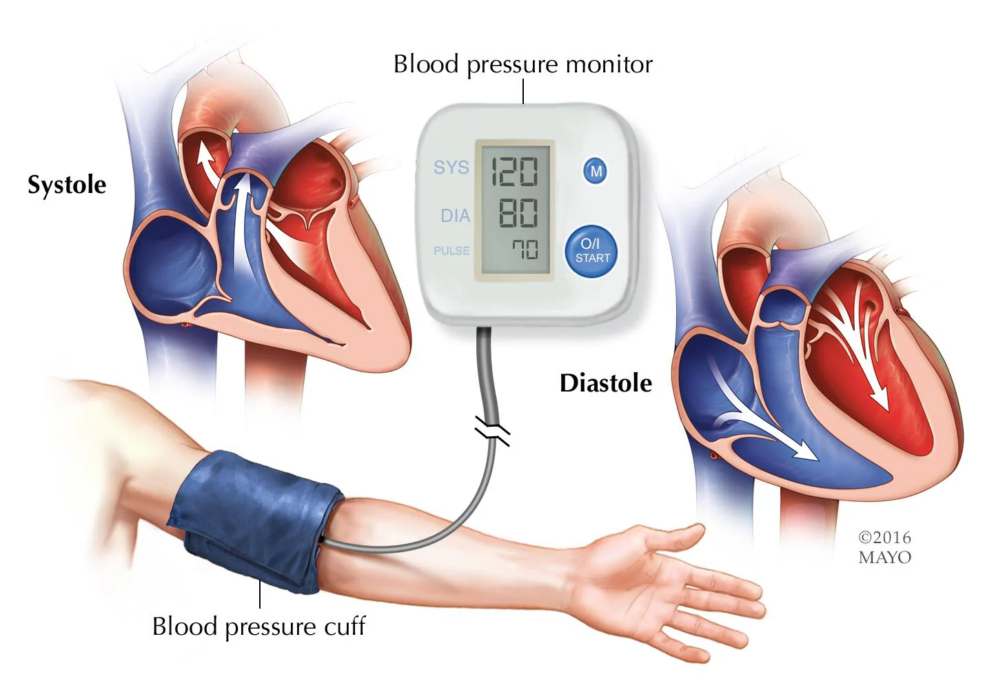 Can I Take an Extra Lisinopril If My Blood Pressure Is High?